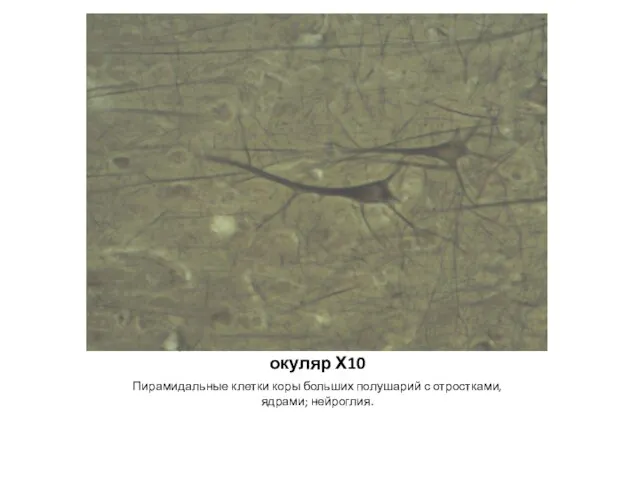 Кора полушарий головного мозга – Объектив Х40; окуляр Х10 Пирамидальные клетки коры