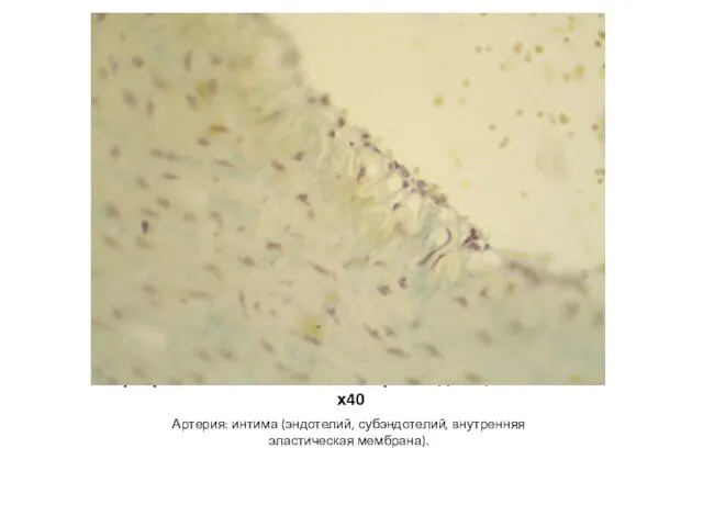 Артерия мышечного типа и сопровождающая ее вена – х40 Артерия: интима (эндотелий, субэндотелий, внутренняя эластическая мембрана).