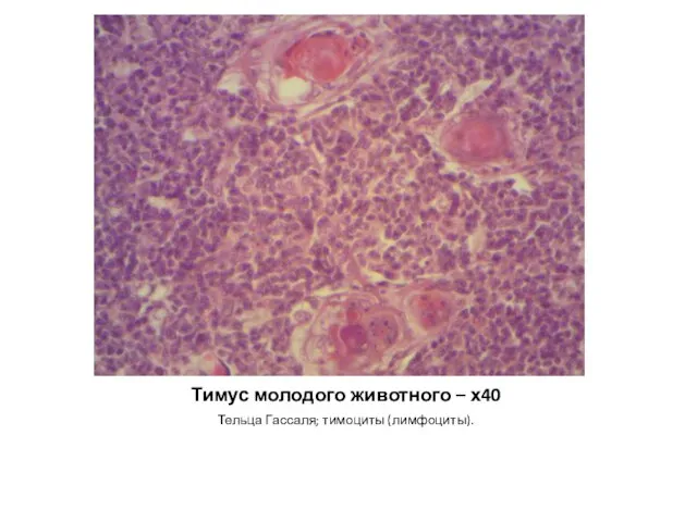 Тимус молодого животного – х40 Тельца Гассаля; тимоциты (лимфоциты).