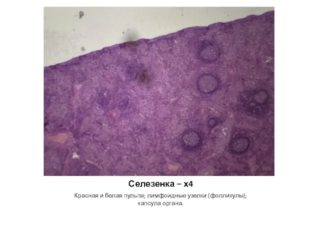 Селезенка – х4 Красная и белая пульпа; лимфоидные узелки (фолликулы); капсула органа.