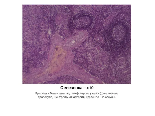 Селезенка – х10 Красная и белая пульпы; лимфоидные узелки (фолликулы); трабекула; центральная артерия; кровеносные сосуды.