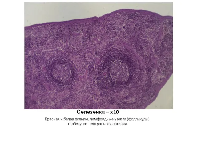 Селезенка – х10 Красная и белая пульпы; лимфоидные узелки (фолликулы); трабекула; центральная артерия.