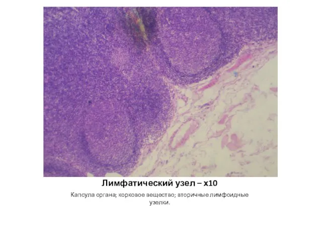 Лимфатический узел – х10 Капсула органа; корковое вещество; вторичные лимфоидные узелки.