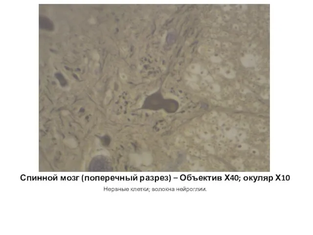Спинной мозг (поперечный разрез) – Объектив Х40; окуляр Х10 Нервные клетки; волокна нейроглии.