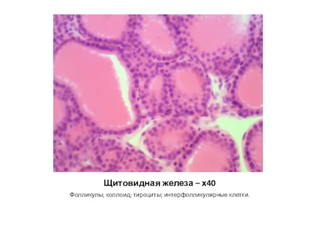 Щитовидная железа – х40 Фолликулы; коллоид; тироциты; интерфолликулярные клетки.