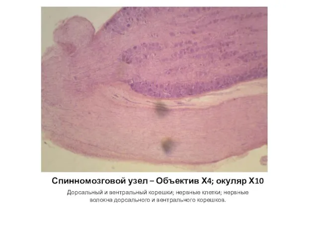 Спинномозговой узел – Объектив Х4; окуляр Х10 Дорсальный и вентральный корешки; нервные