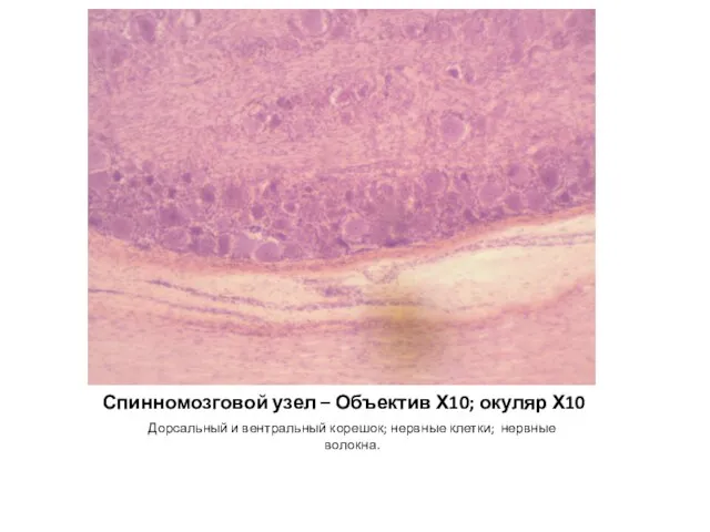 Спинномозговой узел – Объектив Х10; окуляр Х10 Дорсальный и вентральный корешок; нервные клетки; нервные волокна.