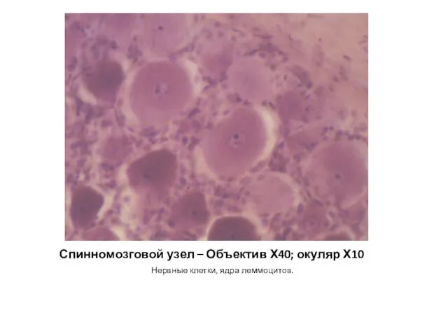 Спинномозговой узел – Объектив Х40; окуляр Х10 Нервные клетки, ядра леммоцитов.