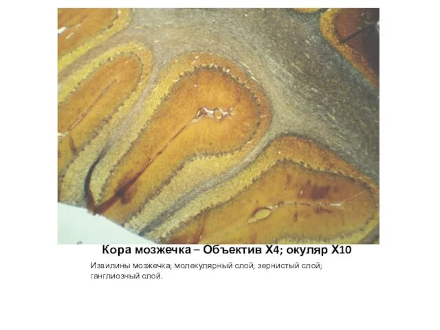 Кора мозжечка – Объектив Х4; окуляр Х10 Извилины мозжечка; молекулярный слой; зернистый слой; ганглиозный слой.