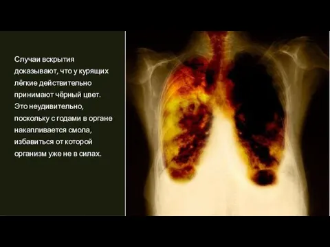 Случаи вскрытия доказывают, что у курящих лёгкие действительно принимают чёрный цвет. Это