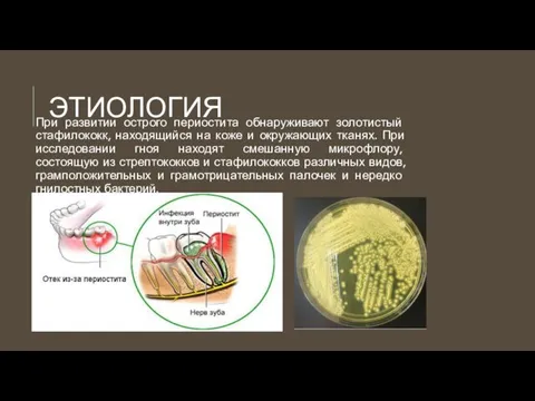 ЭТИОЛОГИЯ При развитии острого периостита обнаруживают золотистый стафилококк, находящийся на коже и