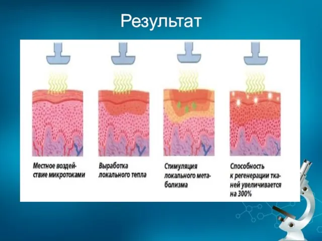 Результат