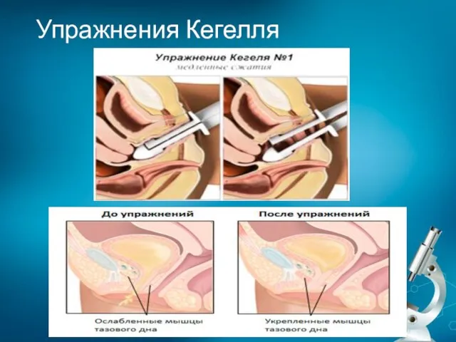 Упражнения Кегелля