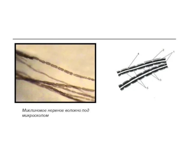 Миелиновое нервное волокно под микроскопом