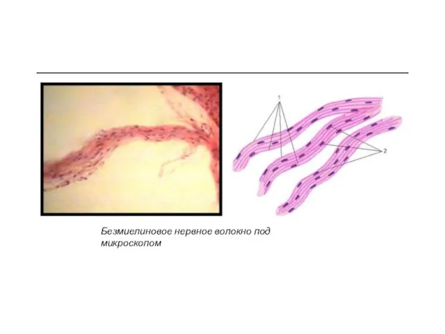 Безмиелиновое нервное волокно под микроскопом