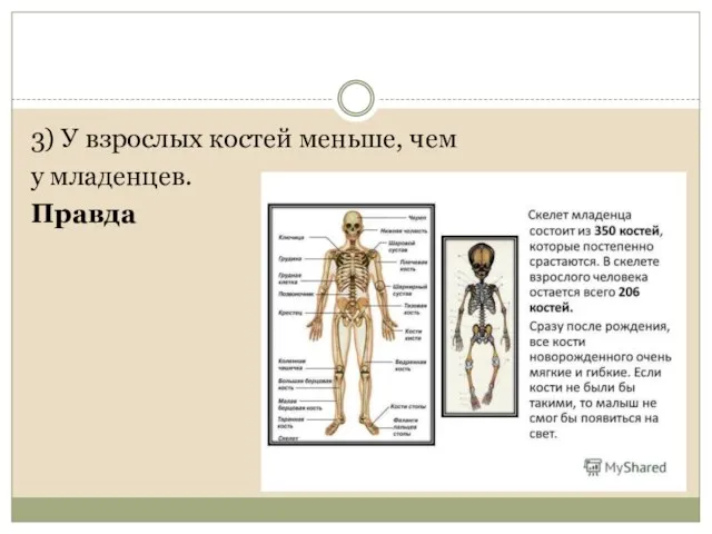 3) У взрослых костей меньше, чем у младенцев. Правда