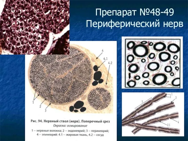 Препарат №48-49 Периферический нерв