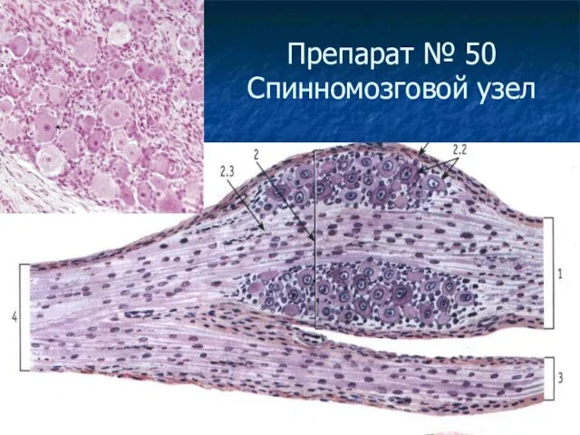 Препарат № 50 Спинномозговой узел