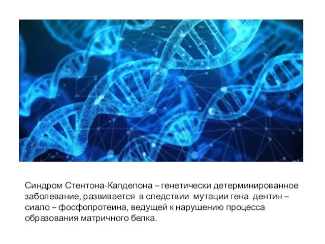 Синдром Стентона-Капдепона – генетически детерминированное заболевание, развивается в следствии мутации гена дентин