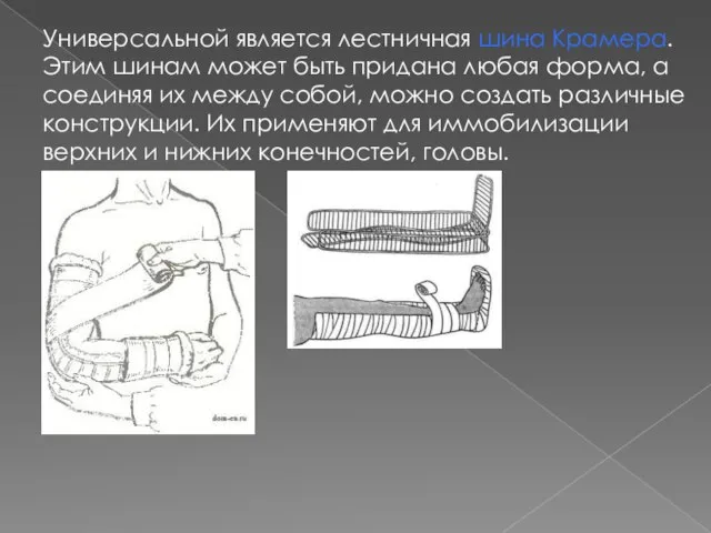 Универсальной является лестничная шина Крамера. Этим шинам может быть придана любая форма,