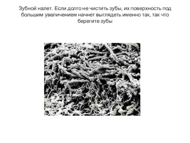 Зубной налет. Если долго не чистить зубы, их поверхность под большим увеличением