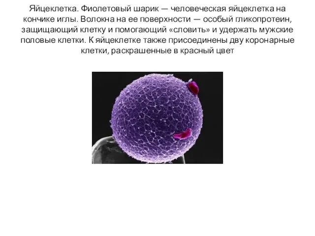 Яйцеклетка. Фиолетовый шарик — человеческая яйцеклетка на кончике иглы. Волокна на ее