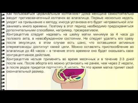 Как пользоваться цервикальным колпачком? Дома женщина самостоятельно вводит противозачаточный колпачок во влагалище.