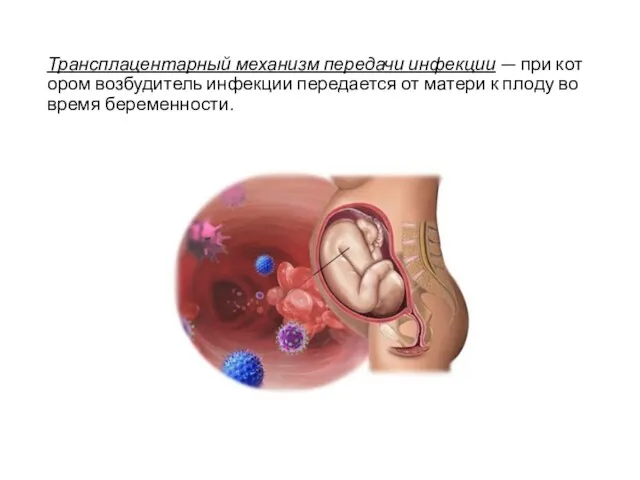 Трансплацентарный механизм передачи инфекции — при котором возбудитель инфекции передается от матери