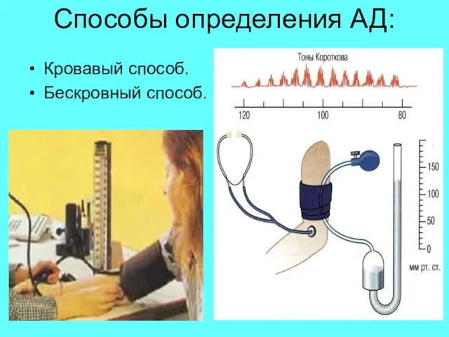 Способы определения АД: Кровавый способ. Бескровный способ.