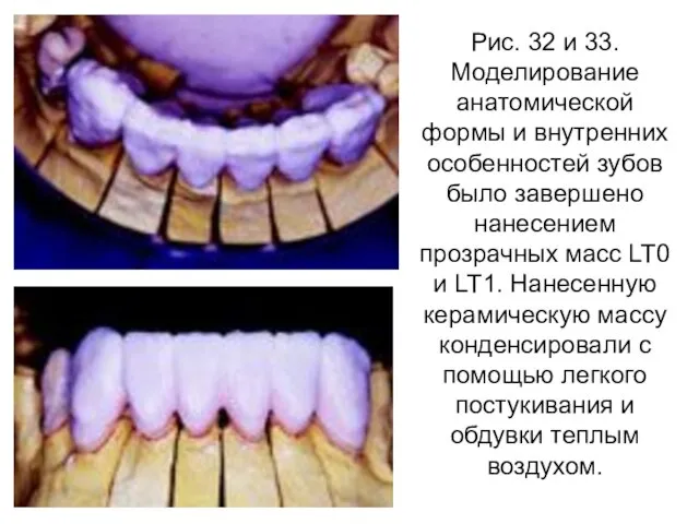 Рис. 32 и 33. Моделирование анатомической формы и внутренних особенностей зубов было