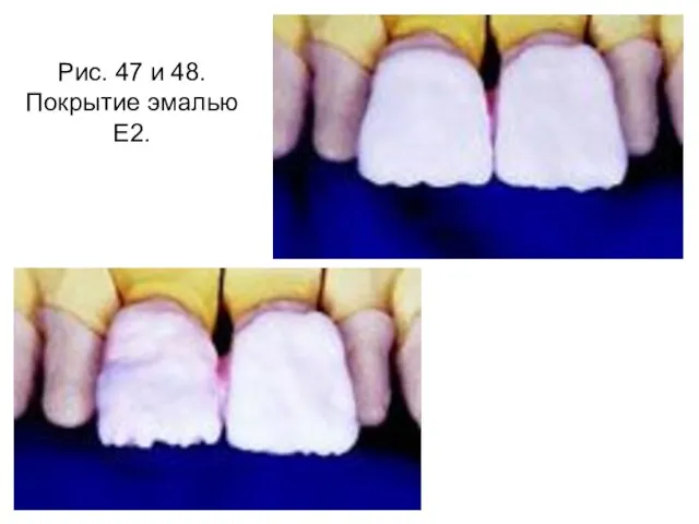 Рис. 47 и 48. Покрытие эмалью Е2.