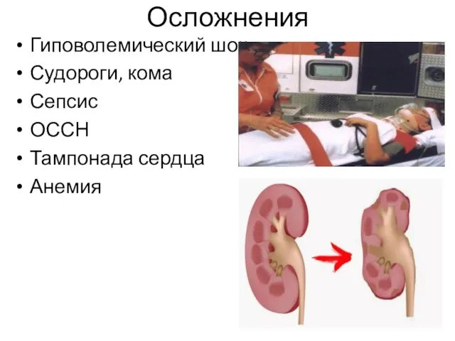 Осложнения Гиповолемический шок Судороги, кома Сепсис ОССН Тампонада сердца Анемия