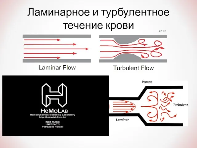 Ламинарное и турбулентное течение крови