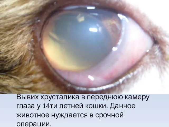 Вывих хрусталика в переднюю камеру глаза у 14ти летней кошки. Данное животное нуждается в срочной операции.