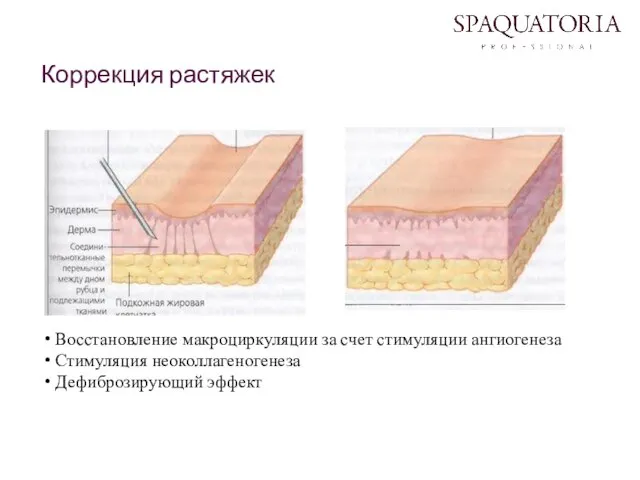 Коррекция растяжек Восстановление макроциркуляции за счет стимуляции ангиогенеза Стимуляция неоколлагеногенеза Дефиброзирующий эффект