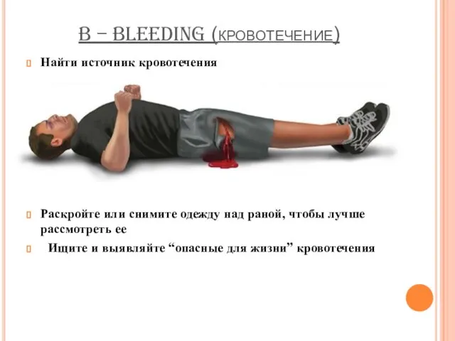 B – BLEEDING (кровотечение) Найти источник кровотечения Раскройте или снимите одежду над