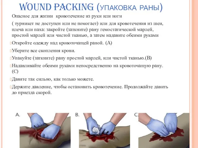 WOUND PACKING (упаковка раны) Опасное для жизни кровотечение из руки или ноги