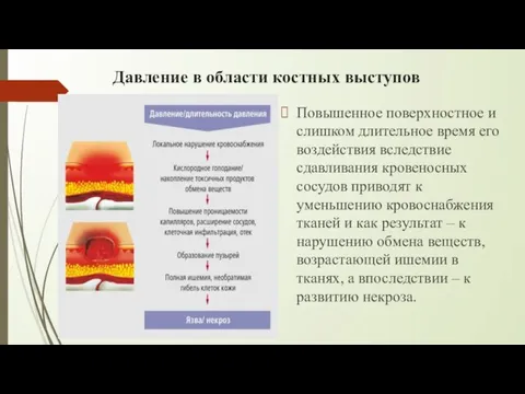 Давление в области костных выступов Повышенное поверхностное и слишком длительное время его