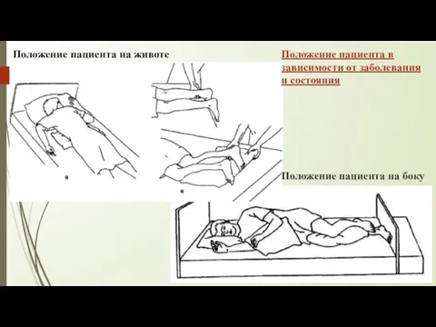 Положение пациента на животе Положение пациента на боку Положение пациента в зависимости от заболевания и состояния