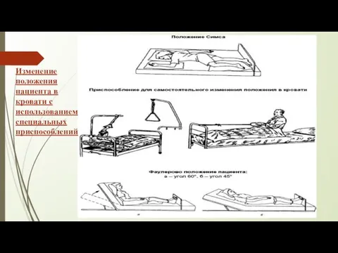 Изменение положения пациента в кровати с использованием специальных приспособлений