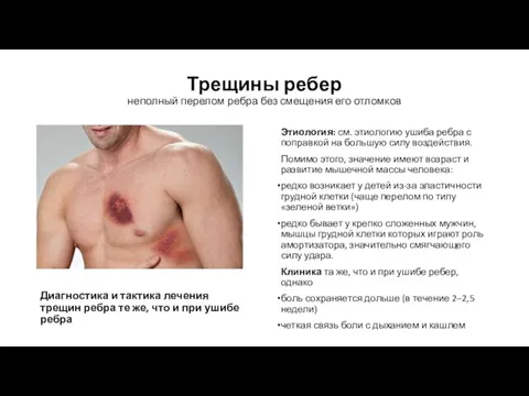 Трещины ребер неполный перелом ребра без смещения его отломков Этиология: см. этиологию