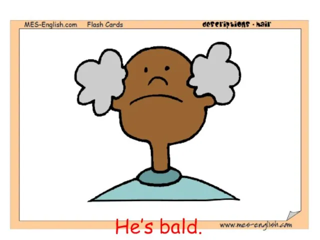 He’s bald.