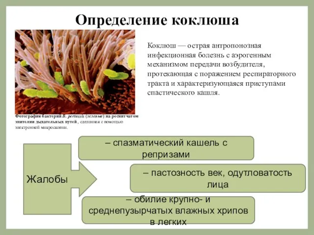 Определение коклюша Жалобы – спазматический кашель с репризами Коклюш — острая антропонозная