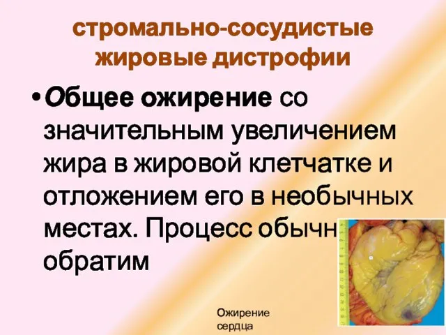 стромально-сосудистые жировые дистрофии Общее ожирение со значительным увеличением жира в жировой клетчатке