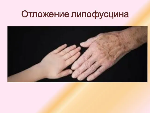 Отложение липофусцина