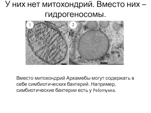 У них нет митохондрий. Вместо них – гидрогеносомы. Вместо митохондрий Архамебы могут