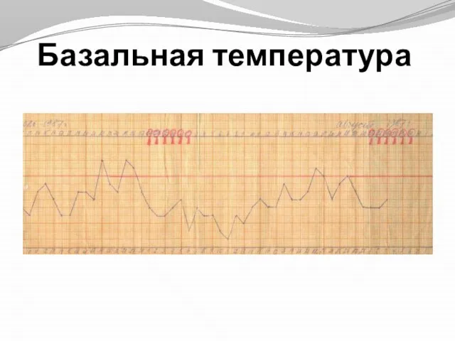 Базальная температура