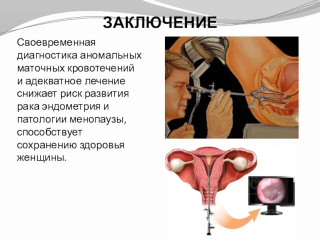 ЗАКЛЮЧЕНИЕ Своевременная диагностика аномальных маточных кровотечений и адекватное лечение снижает риск развития