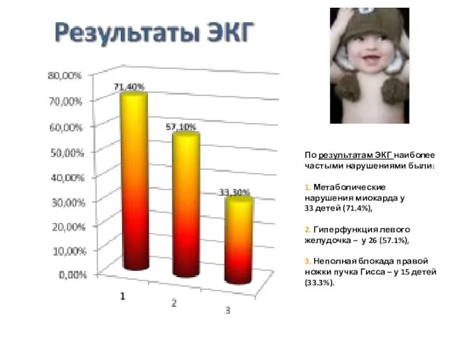 По результатам ЭКГ наиболее частыми нарушениями были: 1. Метаболические нарушения миокарда у