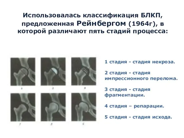 Использовалась классификация БЛКП, предложенная Рейнбергом (1964г), в которой различают пять стадий процесса: